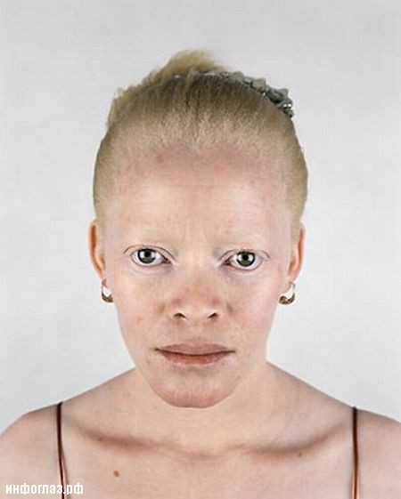 albino07.jpg